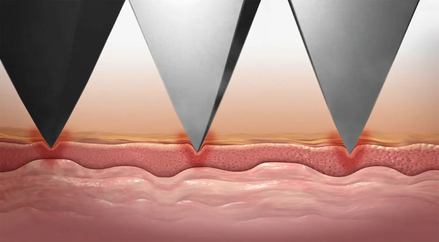 MEZOTIX von Jessica Baumann