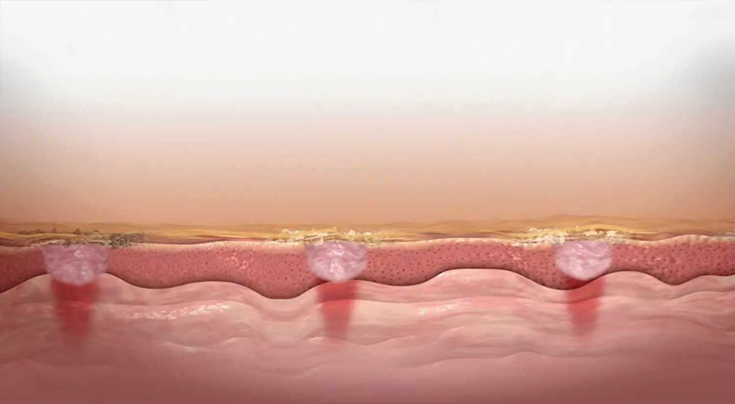 MEZOTIX von Jessica Baumann